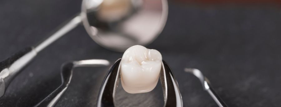 Estrazione dente roma