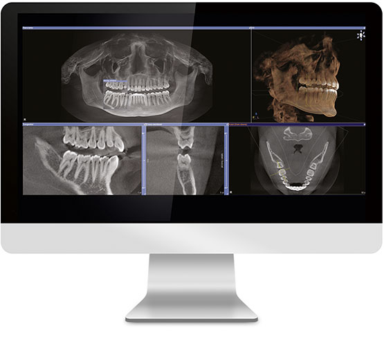 radiologia 3d