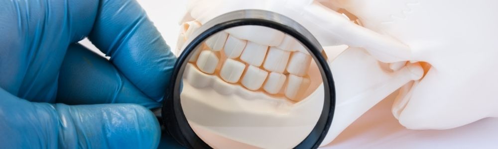 Parodontologia cos'è cure tecniche