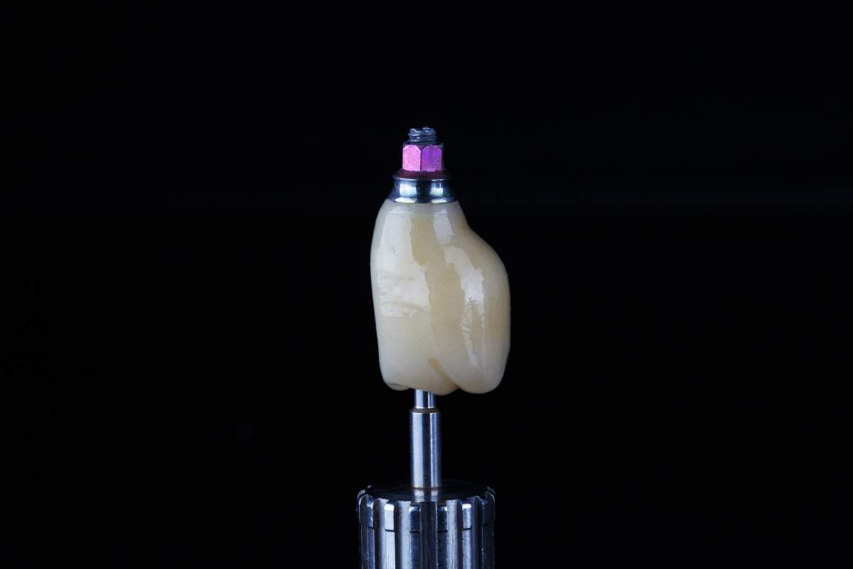 impianti dentali in zirconio vantaggi