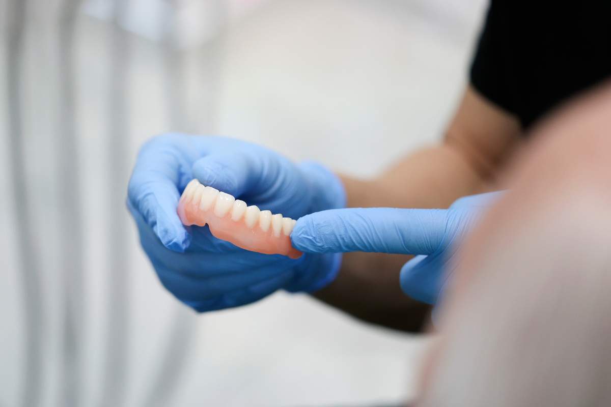 protesi dentaria, cosa è