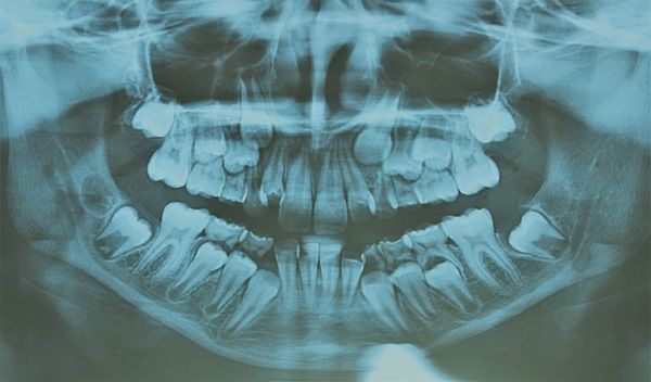 ortopanoramica roma eur