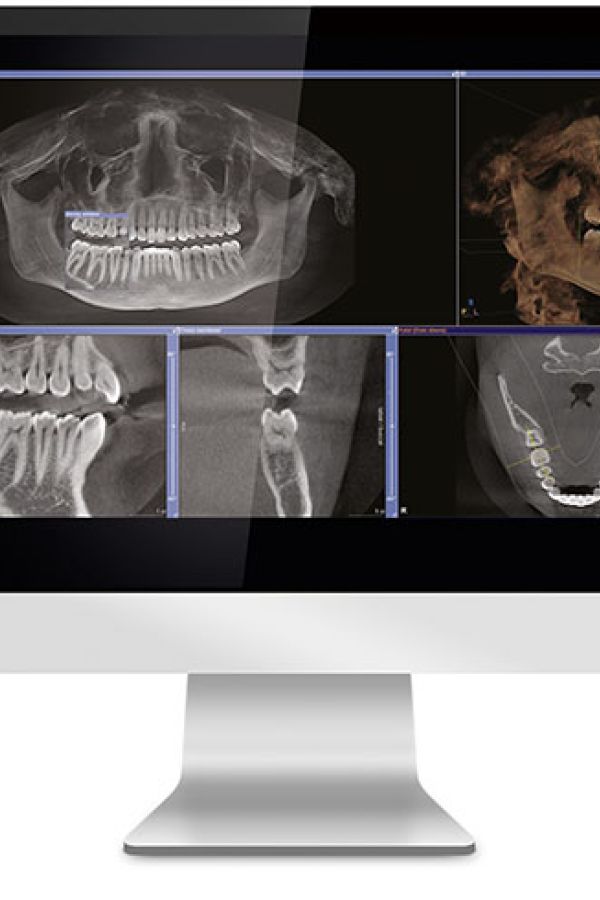 radiologia dentale e tac 3d