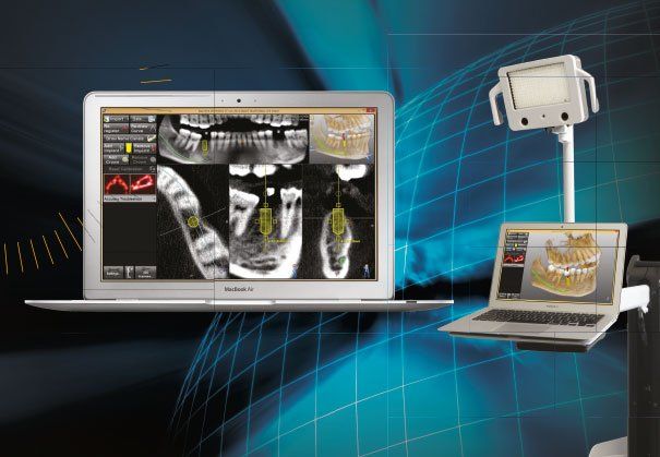 scan devitalizzazione dente presso odontoian Roma