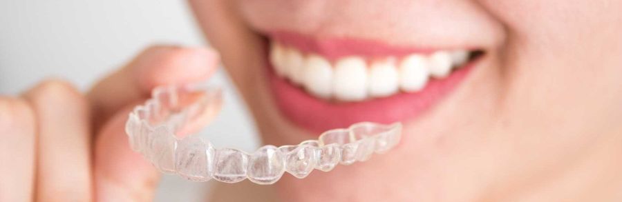 apparecchio invisibile